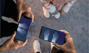 Baixe Xray Scan e Surpreenda em 30s