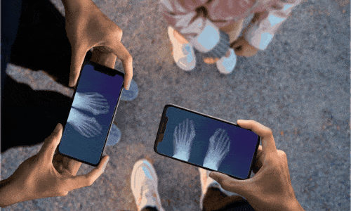 Baixe Xray Scan e Surpreenda em 30s