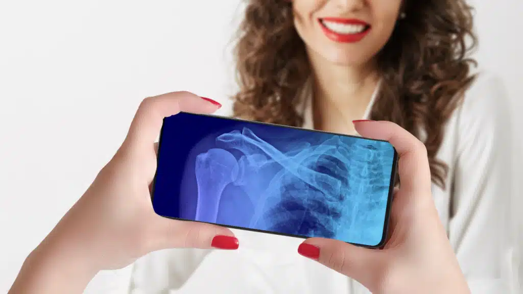 Transforme celular com Xray Scan Filter