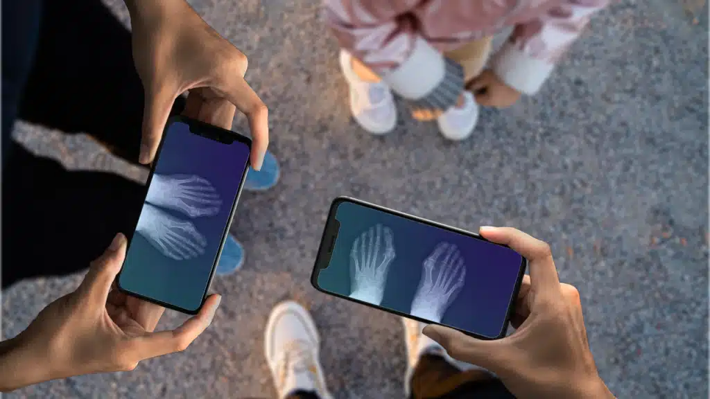 Transforme celular com Xray Scan Filter